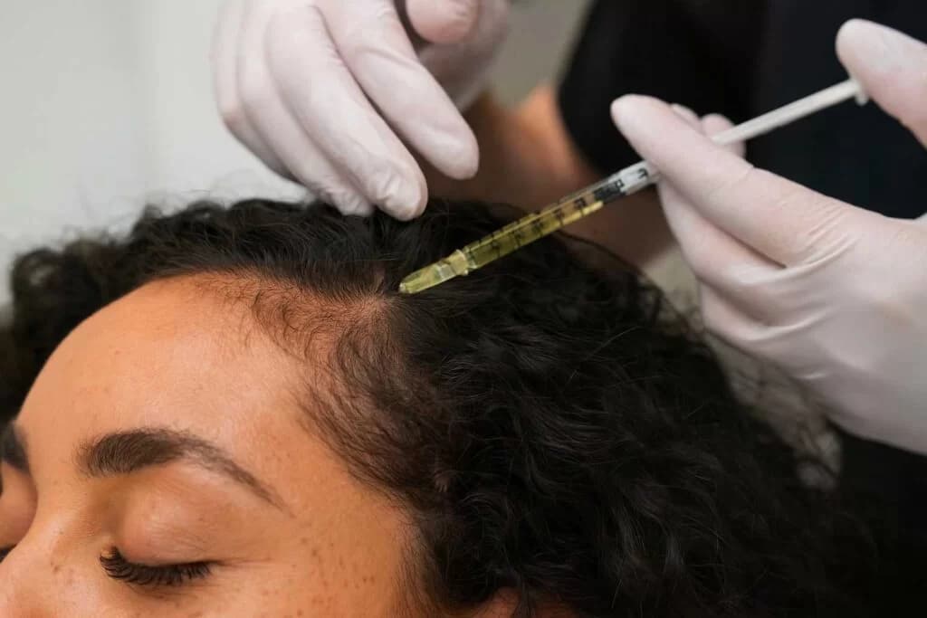 PRP-behandling hos Zanorth Klinik